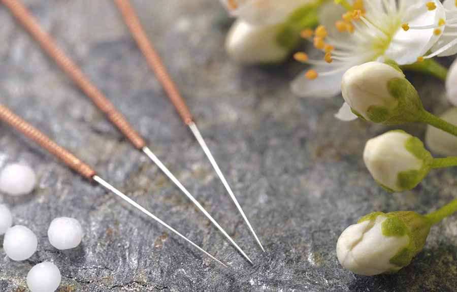 Akupunktur İle Nasıl Zayıflanır?