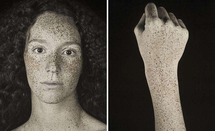 Pierre Ferrer UV Işınlarının Altında İnsan Cildi Fotoğraflandı